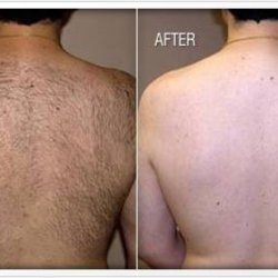 Manscaping by Male cosmetologist (Fairfield) picture